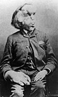 Joseph Carey Merrick (5 August 1862 – 11 April 189